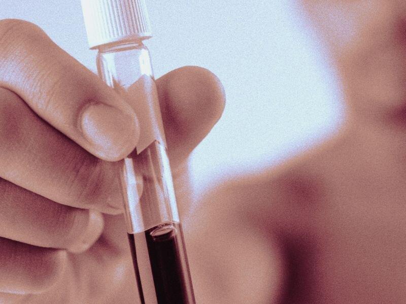 آزمایش خونی که سرطان را سال ها زودتر شناسایی می نماید