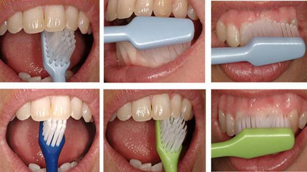 9 اشتباه رایج در مسواک زدن که به دندان ها صدمه می زند
